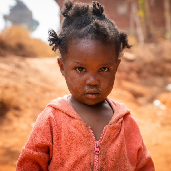 poor-little-girl-wearing-dirty-clothes-in-an-afric-2025-03-09-16-15-32-utc-1.jpg